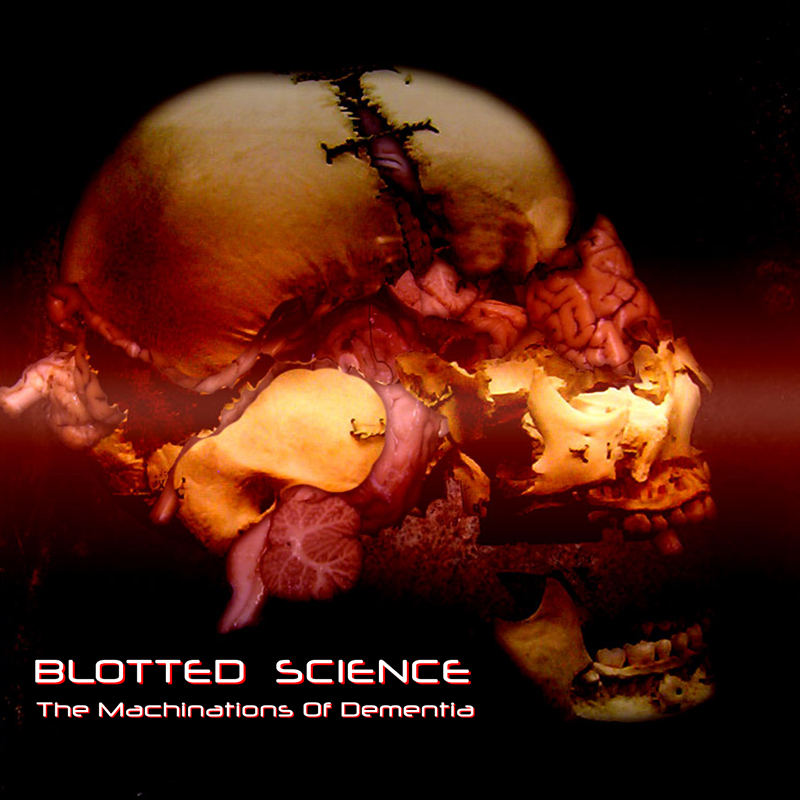 Blotted Science - The Machinations of Dementia cover